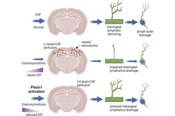 Drug Repairs Systems that Remove Alzheimer's-Causing Waste From the Brain, Study Shows