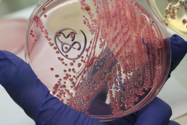 A lab technician holds a bacteria culture that shows a positive infection of enterohemorrhagic E. coli, also known as the EHEC bacteria, from a patient at the University Medical Center Hamburg-Eppendorf on June 2, 2011 in Hamburg, Germany.