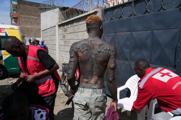 An injured man is treated at the scene of an explosion, in Nairobi, Kenya Friday, Feb. 2, 2024.