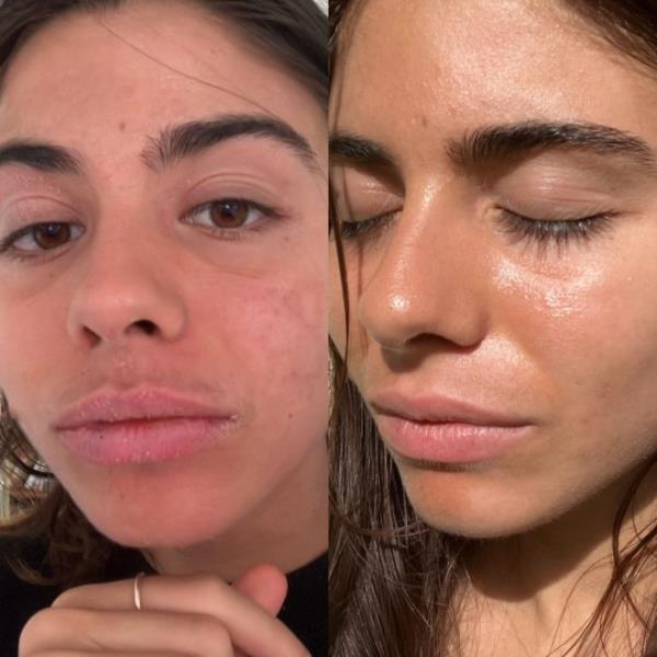 Many users have shared how the cream dramatically reduced sensitive and inflamed skin (Picture: Bescher Beauty)