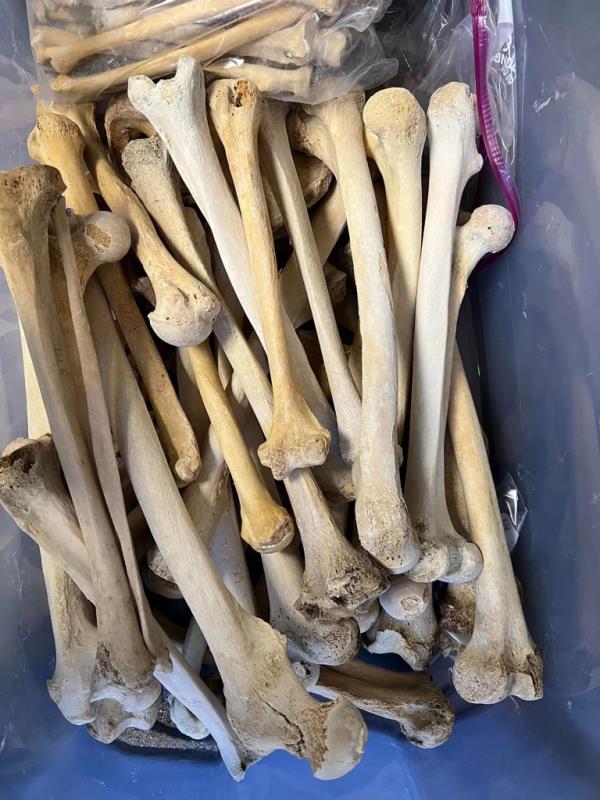 Human bones